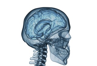 xray